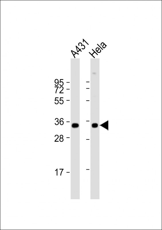 Rabbit anti-PP2A α Polyclonal Antibody(C-term)