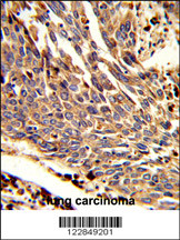 Rabbit anti-ARPC1B Polyclonal Antibody(Center)
