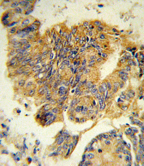 Rabbit anti-CSF3R Polyclonal Antibody(Center)
