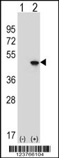 Rabbit anti-EIF4A2 Polyclonal Antibody(C-term)