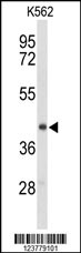 Rabbit anti-ENTPD2 Polyclonal Antibody(N-term)