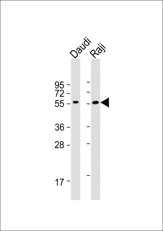 Rabbit anti-FCRL4 Polyclonal Antibody(C-term)