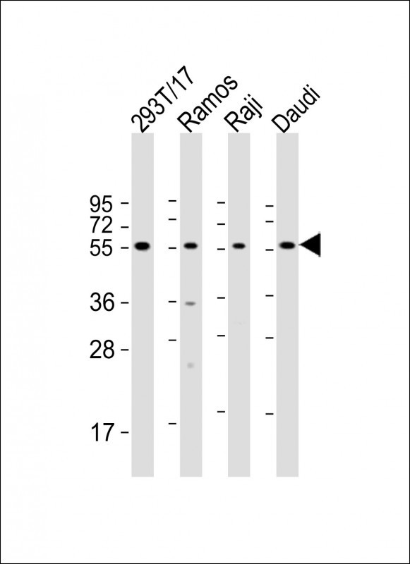 Rabbit anti-FCRL4 Polyclonal Antibody(C-term)