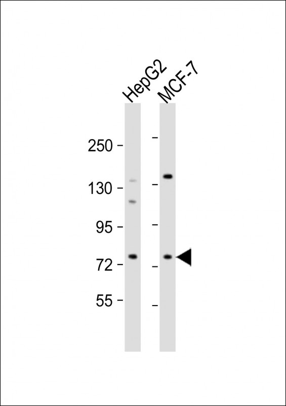 Rabbit anti-DCP1B Polyclonal Antibody(center)