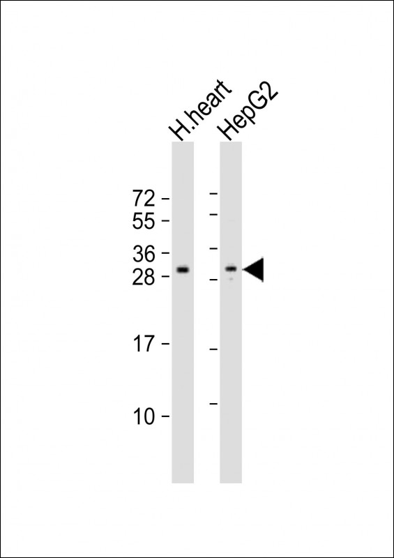 Rabbit anti-AIG1 Polyclonal Antibody(N-term)
