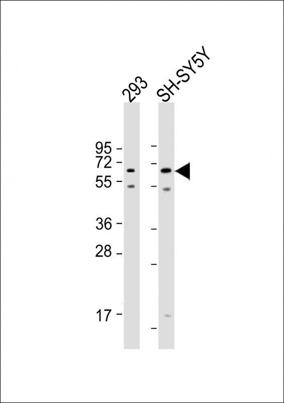Rabbit anti-AMH Polyclonal Antibody(Center)