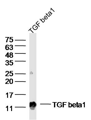 Rabbit anti-TGF-β1 Polyclonal Antibody