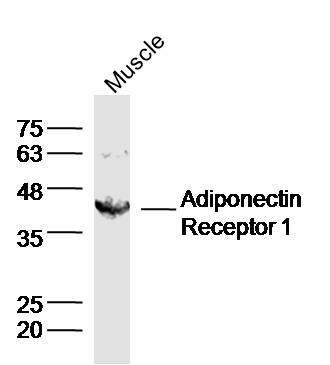 Rabbit anti-Adiponectin Receptor 1 Polyclonal Antibody