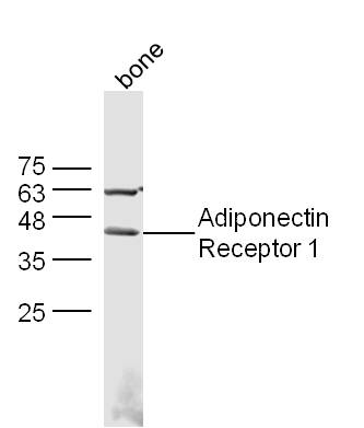 Rabbit anti-Adiponectin Receptor 1 Polyclonal Antibody