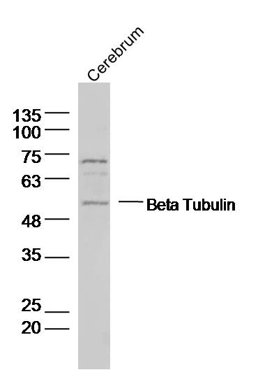 Rabbit anti-β-Tubulin Polyclonal Antibody