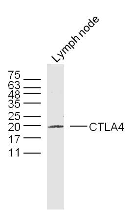 Rabbit anti-CTLA4 Polyclonal Antibody