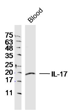 Rabbit anti-IL-17 Polyclonal Antibody