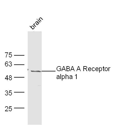 Rabbit anti-GABA A Receptor α1 Polyclonal Antibody