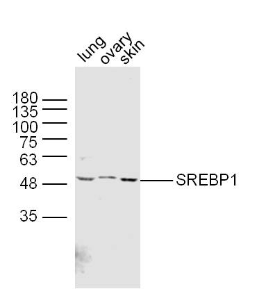 Rabbit anti-SREBP-1/2 Polyclonal Antibody