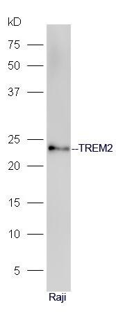 Rabbit anti-TREM2 Polyclonal Antibody