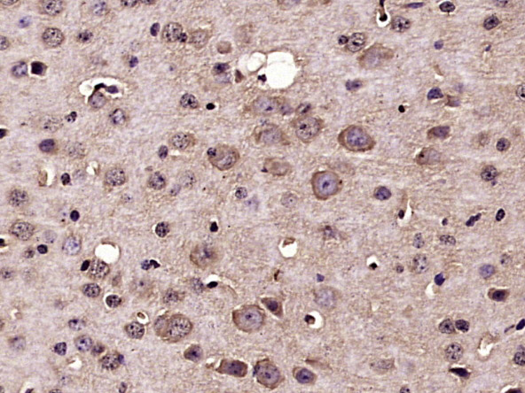 Rabbit anti-Nucleoporin p62 Polyclonal Antibody