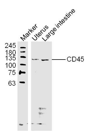 Rabbit anti-CD45 Polyclonal Antibody