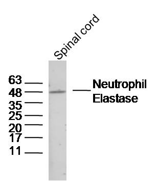 Rabbit anti-Neutrophil Elastase Polyclonal Antibody