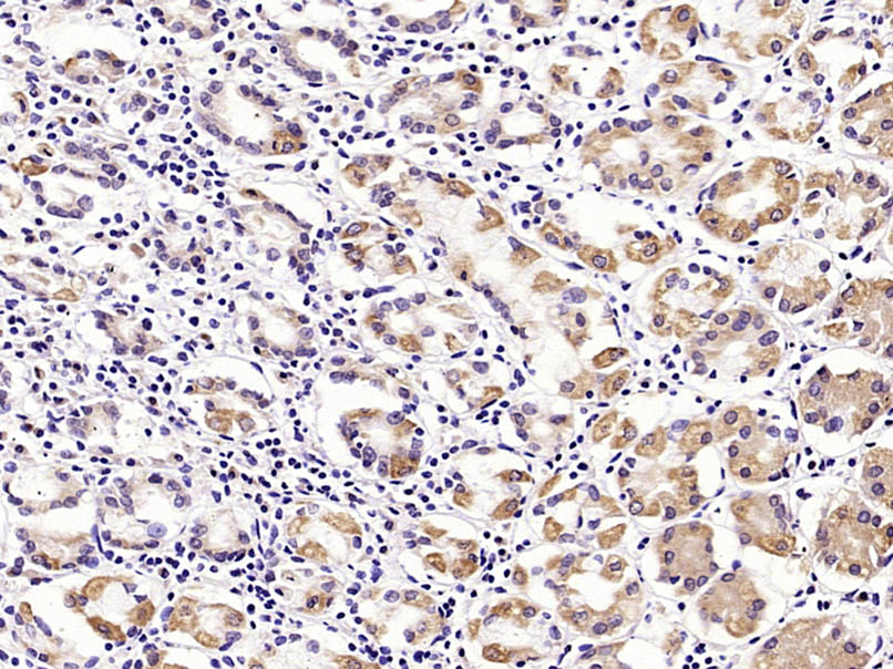 Rabbit anti-MUC5AC Polyclonal Antibody