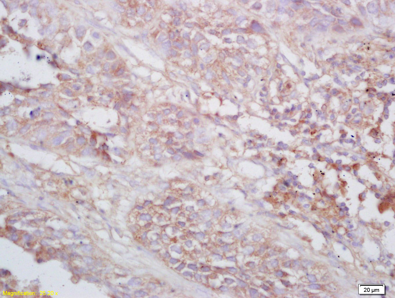 Rabbit anti-Tenomodulin Polyclonal Antibody