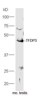 Rabbit anti-TFDP3 Polyclonal Antibody