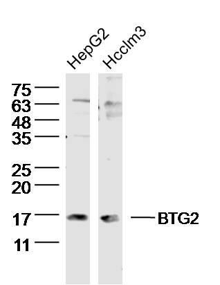 Rabbit anti-BTG2 Polyclonal Antibody