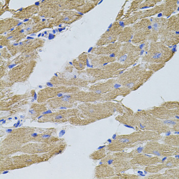 Rabbit anti-CAST Polyclonal Antibody