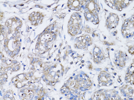 Rabbit anti-BRCA1 Polyclonal Antibody