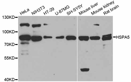 Rabbit anti-HSPA5 Polyclonal Antibody