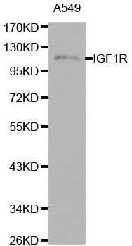 Rabbit anti-IGF1R Polyclonal Antibody