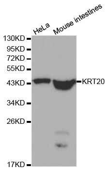 Rabbit anti-KRT20 Polyclonal Antibody