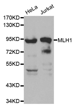 Rabbit anti-MLH1 Polyclonal Antibody