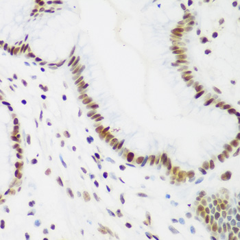Rabbit anti-PCNA Polyclonal Antibody