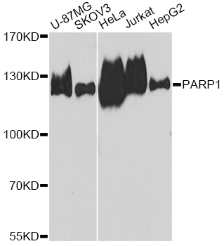 Rabbit anti-PARP1 Polyclonal Antibody