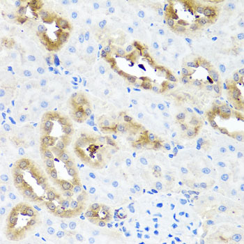 Rabbit anti-FABP5 Polyclonal Antibody