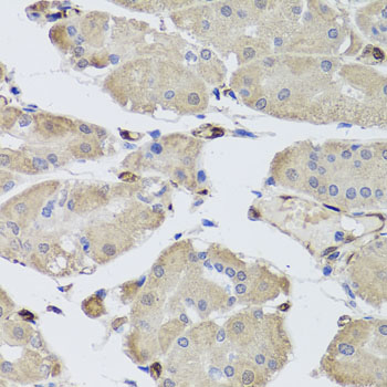 Rabbit anti-FABP5 Polyclonal Antibody