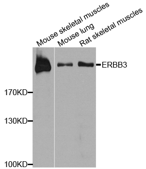 Rabbit anti-ERBB3 Polyclonal Antibody