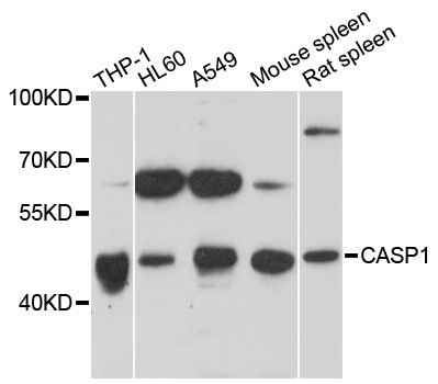 Rabbit anti-CASP1 Polyclonal Antibody