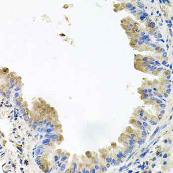 Rabbit anti-PIK3CB Polyclonal Antibody