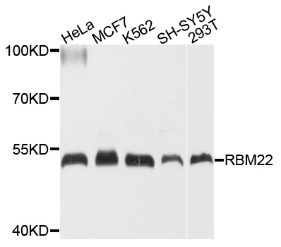Rabbit anti-RBM22 Polyclonal Antibody