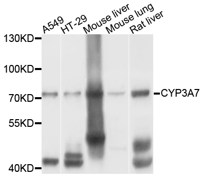 Rabbit anti-CYP3A7 Polyclonal Antibody