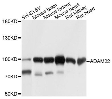 Rabbit anti-ADAM22 Polyclonal Antibody