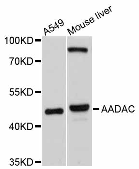 Rabbit anti-AADAC Polyclonal Antibody
