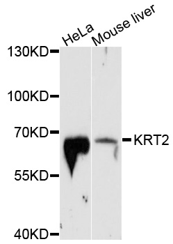Rabbit anti-KRT2 Polyclonal Antibody