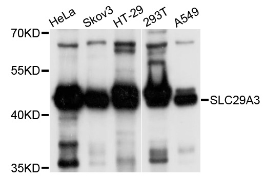 Rabbit anti-SLC29A3 Polyclonal Antibody