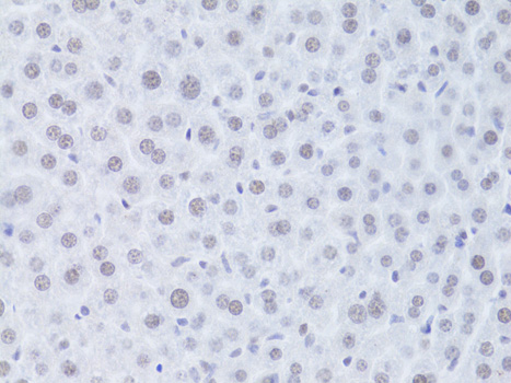 Rabbit anti-CDKN1A Polyclonal Antibody