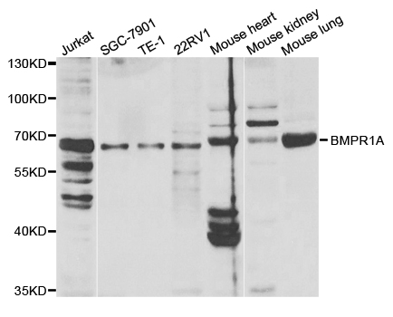 Rabbit anti-BMPR1A Polyclonal Antibody