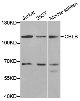 Rabbit anti-CBLB Polyclonal Antibody