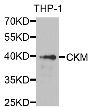 Rabbit anti-CKM Polyclonal Antibody