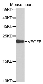 Rabbit anti-VEGFB Polyclonal Antibody